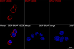 B-Raf (V600E) Recombinant Rabbit Monoclonal Antibody (9O1T9)