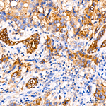 CD66a Antibody in Immunohistochemistry (Paraffin) (IHC (P))