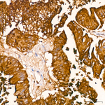 CD66a Antibody in Immunohistochemistry (Paraffin) (IHC (P))