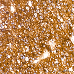 CD66a Antibody in Immunohistochemistry (Paraffin) (IHC (P))