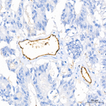 ICAM-2 Recombinant Rabbit Monoclonal Antibody (9C2P6)
