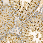 STIM1 Recombinant Rabbit Monoclonal Antibody (2M5B0)