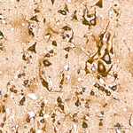 Calreticulin Antibody in Immunohistochemistry (Paraffin) (IHC (P))