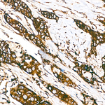 Calreticulin Antibody in Immunohistochemistry (Paraffin) (IHC (P))