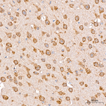 Calreticulin Antibody in Immunohistochemistry (Paraffin) (IHC (P))