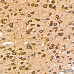 Calreticulin Antibody in Immunohistochemistry (Paraffin) (IHC (P))