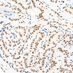 FAM208A Recombinant Rabbit Monoclonal Antibody (8T1X7)