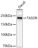 FAM208A Antibody in Western Blot (WB)