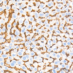 ICAM-1 Antibody in Immunohistochemistry (Paraffin) (IHC (P))