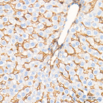 ICAM-1 Antibody in Immunohistochemistry (Paraffin) (IHC (P))