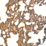 ICAM-1 Antibody in Immunohistochemistry (Paraffin) (IHC (P))