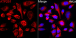 PMCA1 ATPase Antibody in Immunocytochemistry (ICC/IF)