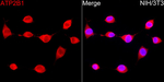 PMCA1 ATPase Recombinant Rabbit Monoclonal Antibody (4J0R4)