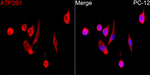 PMCA1 ATPase Antibody in Immunocytochemistry (ICC/IF)