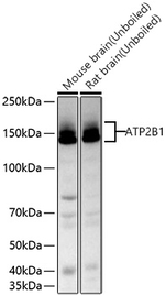 PMCA1 ATPase Antibody in Western Blot (WB)