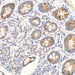 HIBADH Antibody in Immunohistochemistry (Paraffin) (IHC (P))
