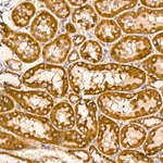 HIBADH Antibody in Immunohistochemistry (Paraffin) (IHC (P))