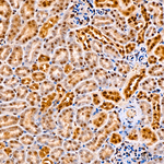 CREB3L2 Antibody in Immunohistochemistry (Paraffin) (IHC (P))