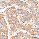 AUH Antibody in Immunohistochemistry (Paraffin) (IHC (P))