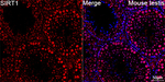 SIRT1 Antibody in Immunohistochemistry (Paraffin) (IHC (P))