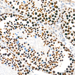 SIRT1 Antibody in Immunohistochemistry (Paraffin) (IHC (P))