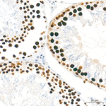 SIRT1 Antibody in Immunohistochemistry (Paraffin) (IHC (P))
