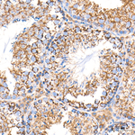 COX5B Antibody in Immunohistochemistry (Paraffin) (IHC (P))