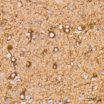 COX5B Antibody in Immunohistochemistry (Paraffin) (IHC (P))