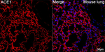 ACE Recombinant Rabbit Monoclonal Antibody (2P9B6)