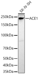 ACE Antibody in Western Blot (WB)