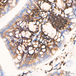 CD44 Antibody in Immunohistochemistry (Paraffin) (IHC (P))