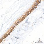 CD44 Antibody in Immunohistochemistry (Paraffin) (IHC (P))