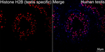 Histone H2B Antibody in Immunohistochemistry (Paraffin) (IHC (P))