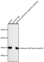 Histone H2B Antibody in Immunoprecipitation (IP)