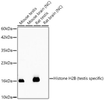 Histone H2B Antibody in Western Blot (WB)