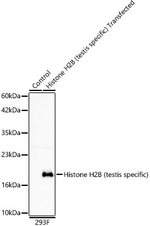 Histone H2B Antibody in Western Blot (WB)