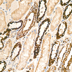 MTX2 Antibody in Immunohistochemistry (Paraffin) (IHC (P))