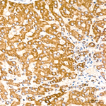 MTX2 Antibody in Immunohistochemistry (Paraffin) (IHC (P))