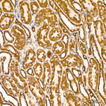 MTX2 Recombinant Rabbit Monoclonal Antibody (3A8X10)