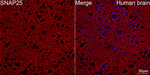 SNAP25 Antibody in Immunohistochemistry (Paraffin) (IHC (P))