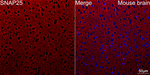 SNAP25 Recombinant Rabbit Monoclonal Antibody (10W4W5)