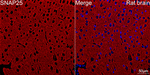 SNAP25 Antibody in Immunohistochemistry (Paraffin) (IHC (P))