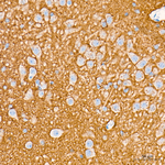 SNAP25 Antibody in Immunohistochemistry (Paraffin) (IHC (P))