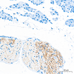 SNAP25 Antibody in Immunohistochemistry (Paraffin) (IHC (P))
