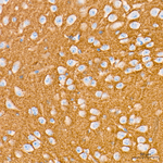 SNAP25 Antibody in Immunohistochemistry (Paraffin) (IHC (P))