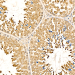 SRPK1 Antibody in Immunohistochemistry (Paraffin) (IHC (P))