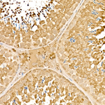 SRPK1 Antibody in Immunohistochemistry (Paraffin) (IHC (P))