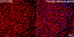 CYP11B2 Antibody in Immunohistochemistry (Paraffin) (IHC (P))