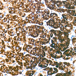 CYP11B2 Antibody in Immunohistochemistry (Paraffin) (IHC (P))