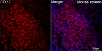 CD22 Antibody in Immunohistochemistry (Paraffin) (IHC (P))